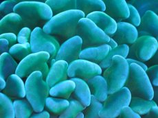 画像2: 【サンゴまとめ買い割り引き対象商品30周年セール】 【サンゴ】【通販】ナガレハナサンゴ（Yellow/Green）SMサイズ（個体販売）No.13（生体）（サンゴ） (2)